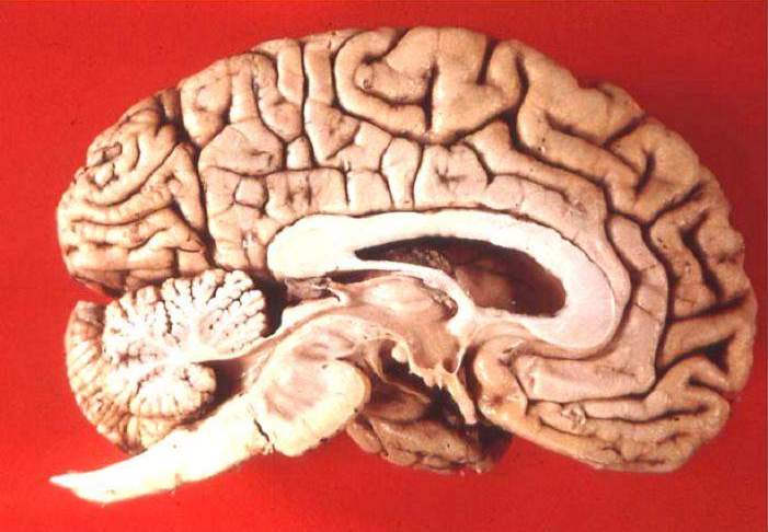 Human_brain_midsagittal_cut_