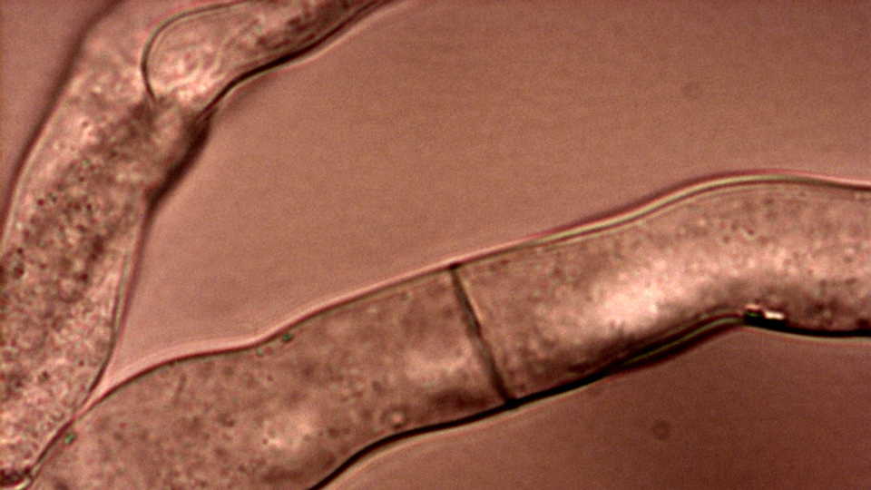 The fungus Neurospora crassa, by Roland Gromes